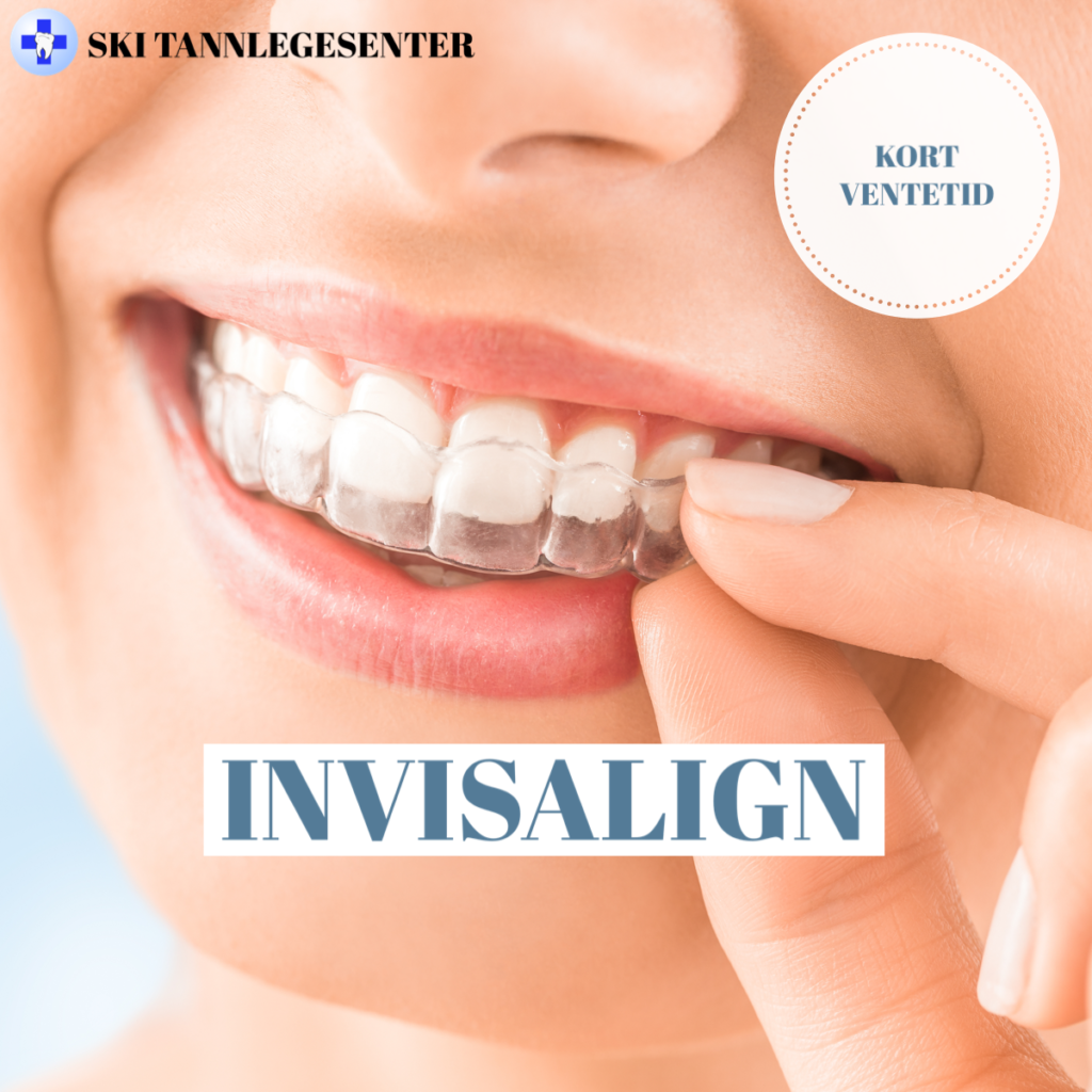 Invisalign – Ski Tannlegesenter Og Tannlegevakt